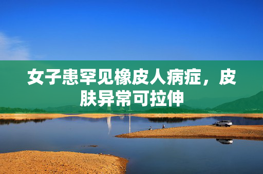 女子患罕见橡皮人病症，皮肤异常可拉伸