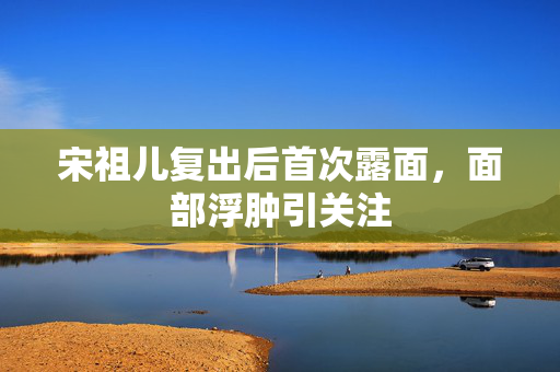 宋祖儿复出后首次露面，面部浮肿引关注