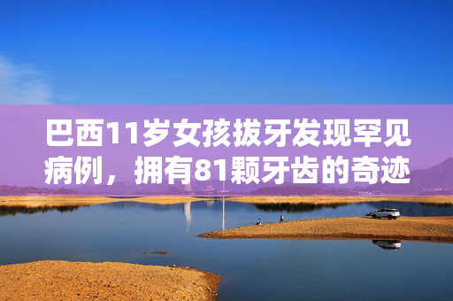 巴西11岁女孩拔牙发现罕见病例，拥有81颗牙齿的奇迹